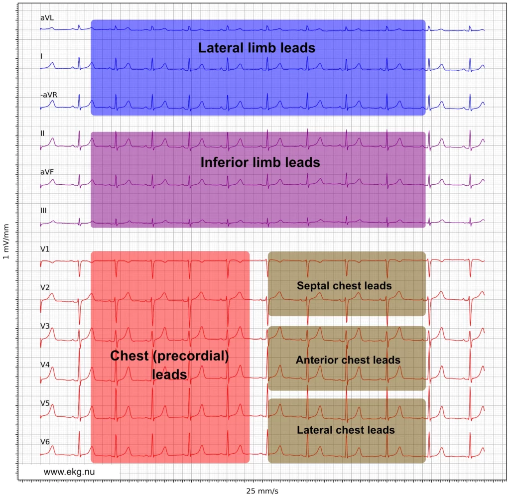 12 lead ecg leads limb chest cabrera format paper