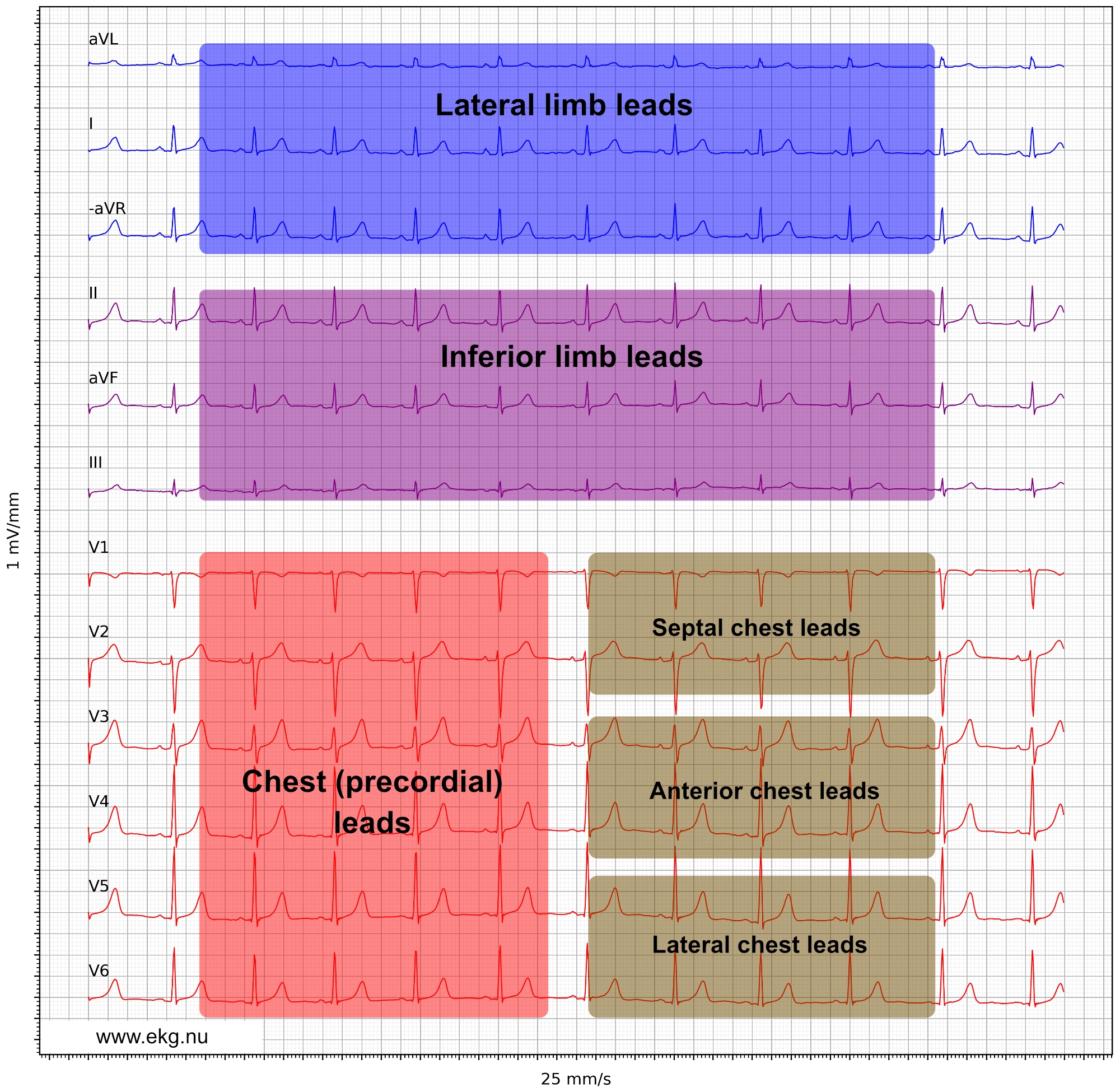 12 lead ecg leads limb chest cabrera format paper